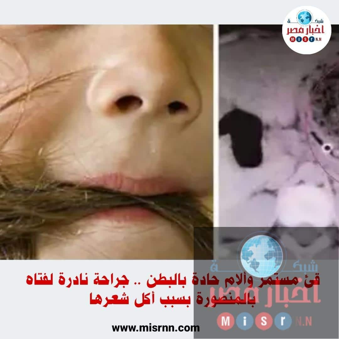 فتاه تأكل شعرها